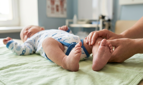 pé torto congênito